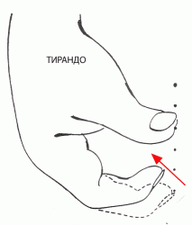 Уроки гитары – Способы звукоизвлечения: Тирандо – Урок 8